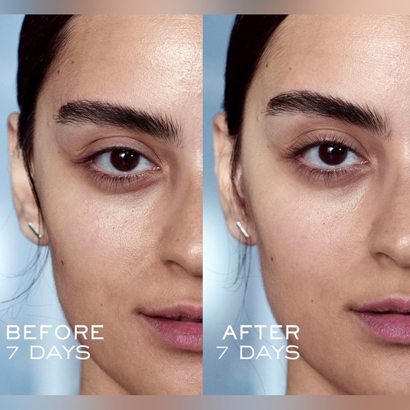 Lancôme Advanced Génifique Radiance Boosting Face Serum - Picture 6 of 11